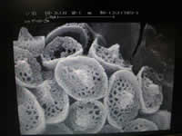 A one-celled (!) coccolithophore, &ldquo;Mexican Sombreros&rdquo;